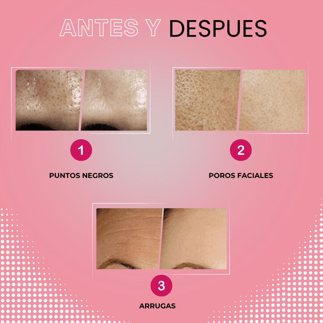 Limpiador Ultrasónico Nanni® 2.0