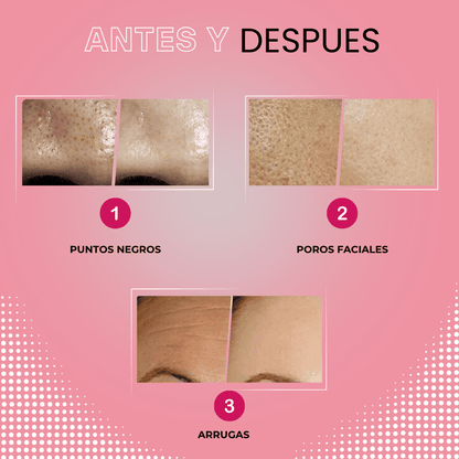 Limpiador Ultrasónico Nanni® 2.0