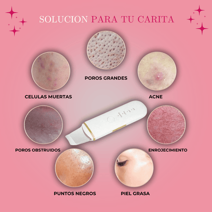 Limpiador Ultrasónico Nanni® 2.0